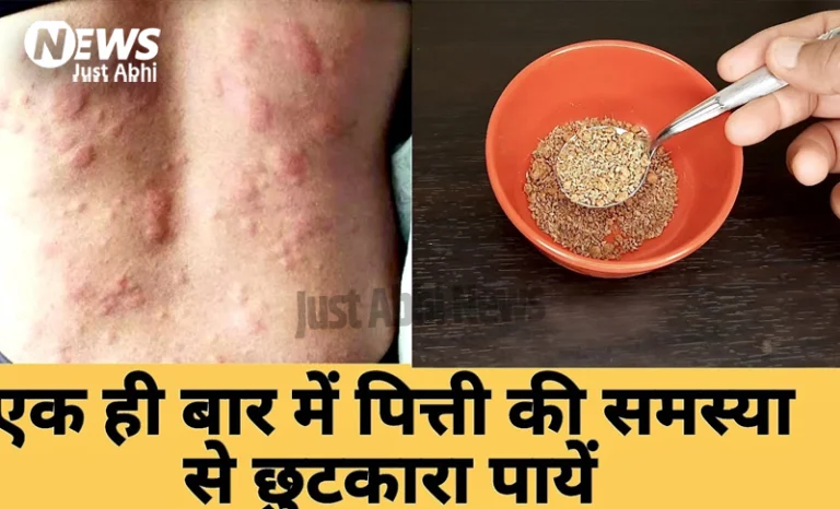 अगर आपको पित्ती हो गई है तो घबराएं नहीं, इन घरेलू उपायों से करें जल्दी ठीक। नहीं लेना पड़ेगा दवा का सहारा ☉! अगर आपको पित्ती हो गई है तो घबराएं नहीं, इन घरेलू उपायों से करें जल्दी ठीक। नहीं लेना पड़ेगा दवा का सहारा ☉!
