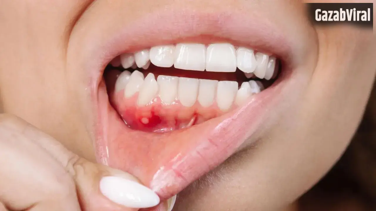 Gum Problems: क्या आपके मसूड़ों से भी आता है खून? भूलकर भी न करें नजरअंदाज, एक्सपर्ट ने बताए इसके बड़े कारण