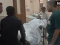 कानपुर के कल्याणपुर में रिटायर्ड दरोगा के बेटे को दबंगो ने मारी गोली, पुरानी रंजिश में दिया वारदात को अंजाम​