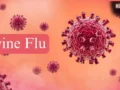 Swine Flu Prevention: बारिश के मौसम में क्यों बढ़ जाता है स्वाइन फ्लू का खतरा? जानें कैसे करें बचाव​