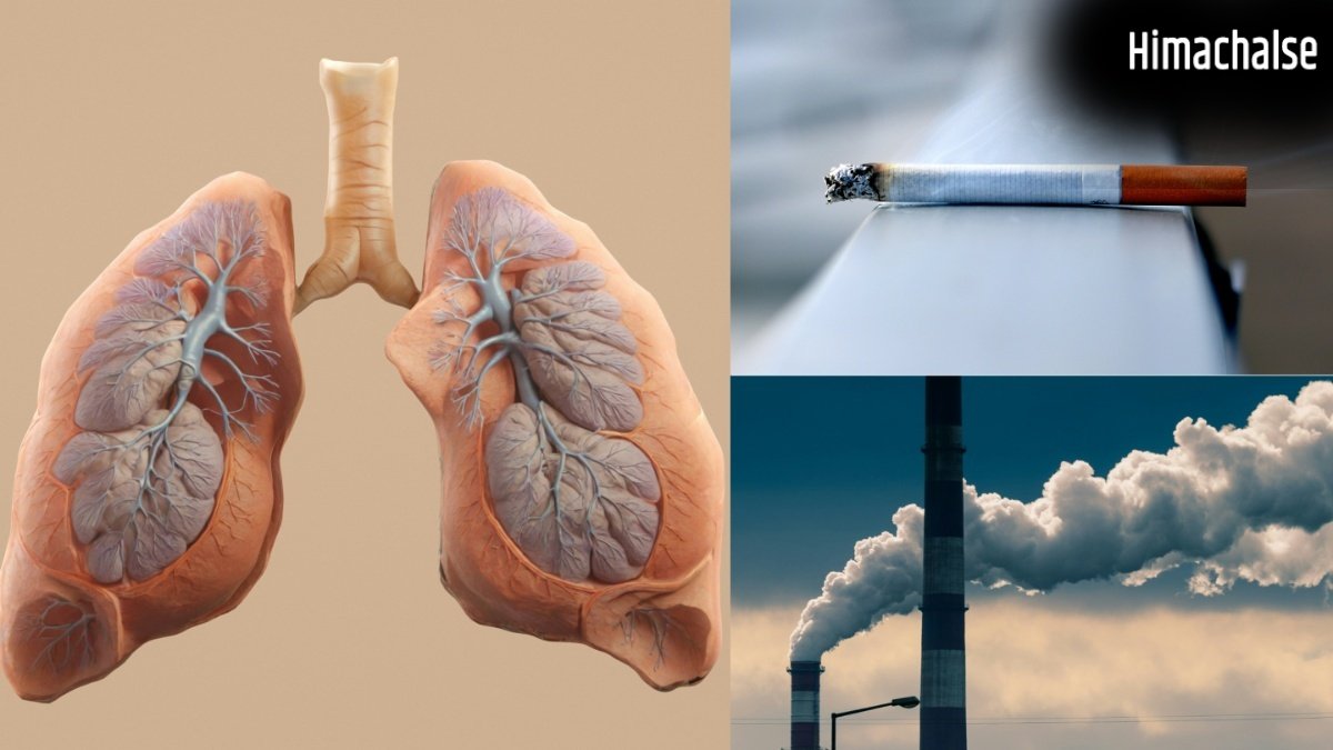 वायु प्रदूषण या स्मोकिंग? एक्सपर्ट से जानें फेफड़ों को किससे पहुंचता है ज्यादा नुकसान?​