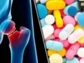 Vitamin D Supplements: क्या आपकी हड्डियां सिर्फ सप्लीमेंट्स के भरोसे हैं? जानिए एक्सपर्ट की राय