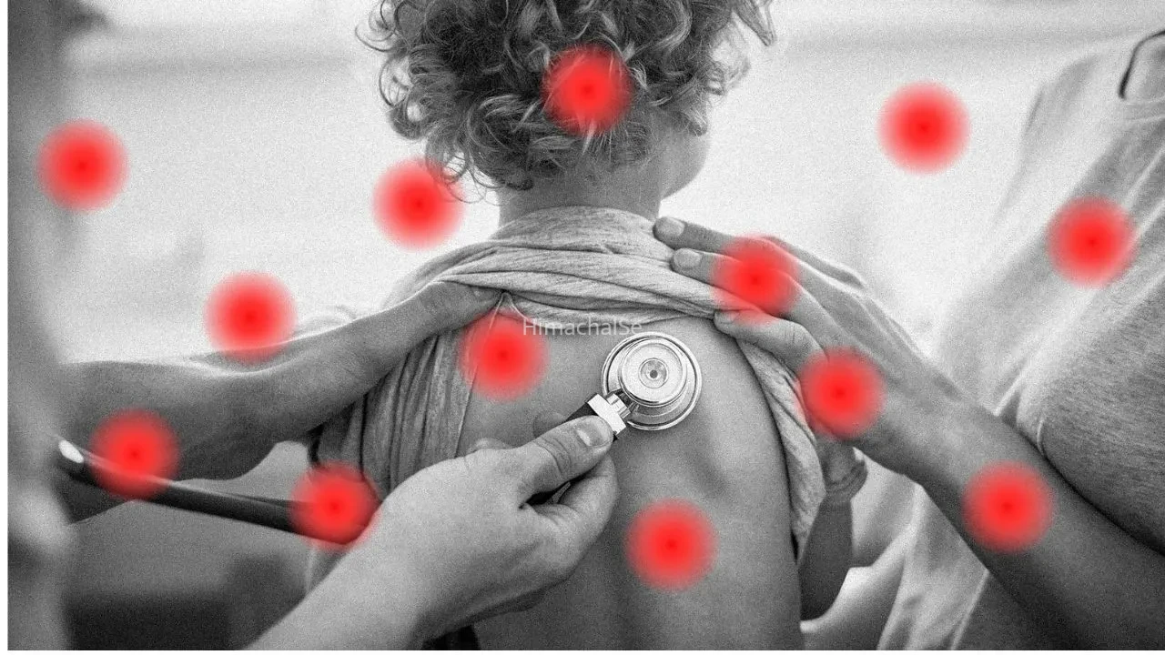 Measles Symptoms: क्या होता है खसरा? बच्चे ही नहीं, बड़ों को भी होता है खतरा, जानें क्या करें और क्या न करें​