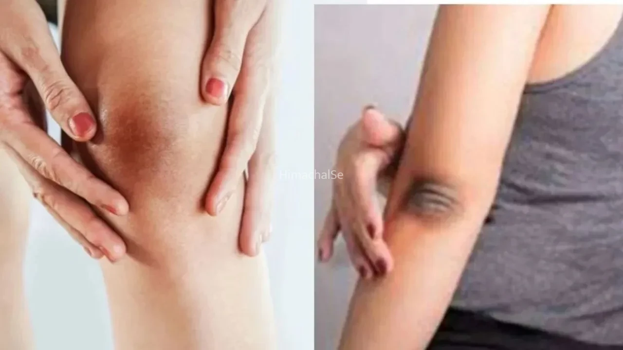 Skin Care Tips: कोहनी और घुटनों की जिद्दी कालापन से हैं परेशान? ये 6 घरेलू उपाय कर सकते हैं कमाल​