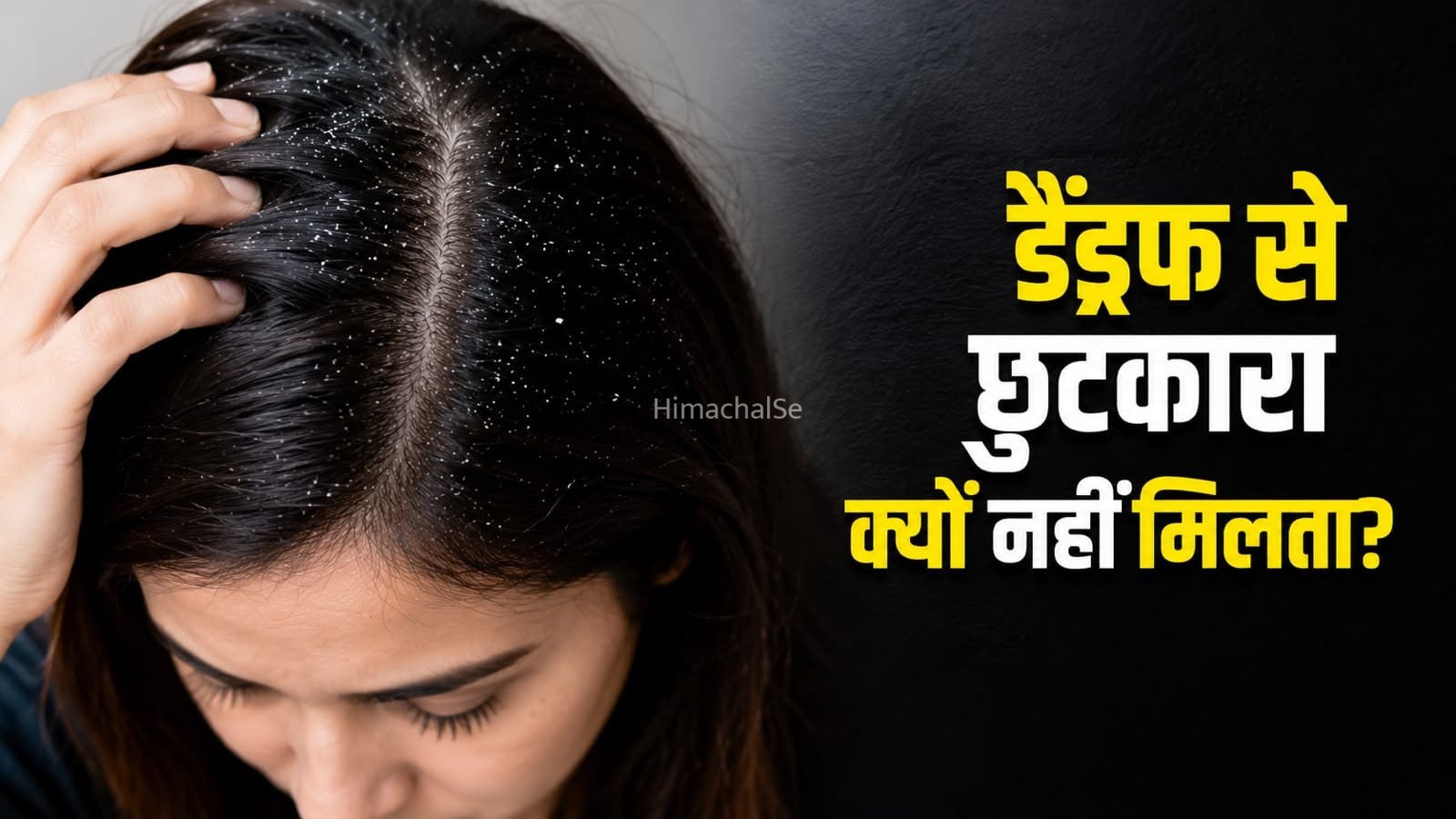 डैंड्रफ का बार-बार लौटना पड़ सकता है भारी, जानें कहां हो रही है गलती​
