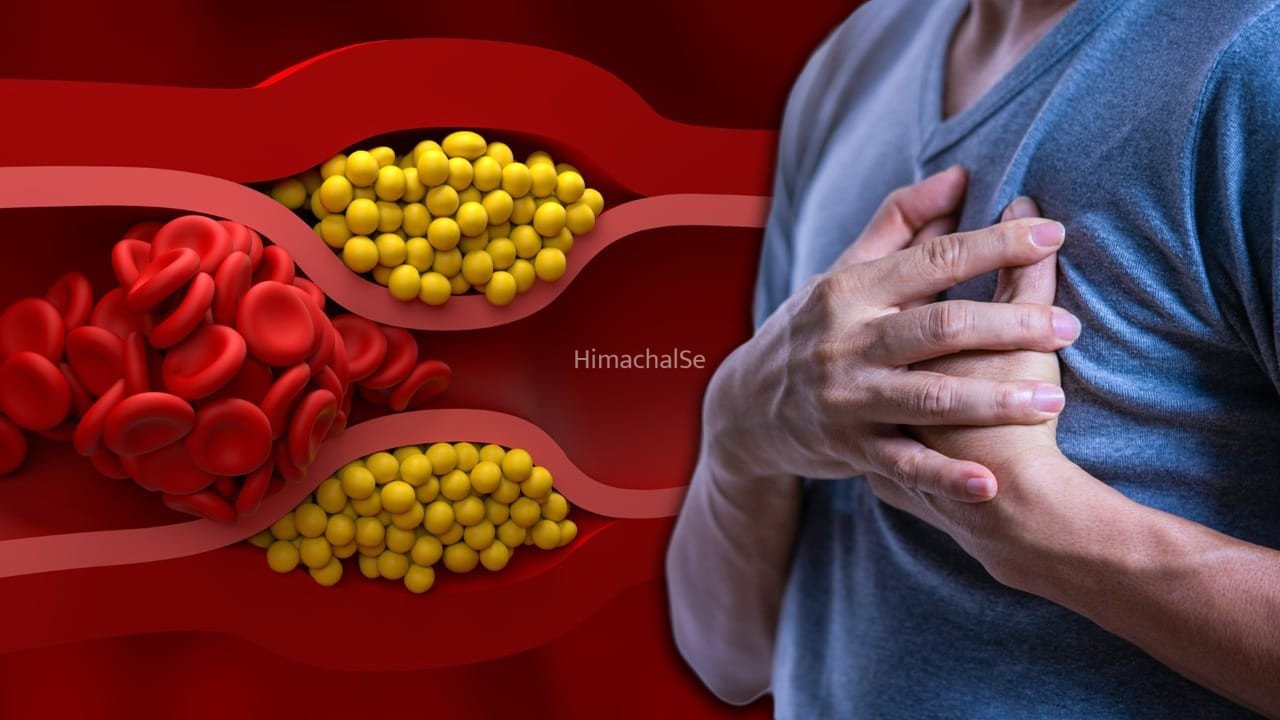 High Cholesterol: हाई कोलेस्ट्रॉल क्यों हो जाता है? ये गलतियां इसकी वजह बनती हैं​