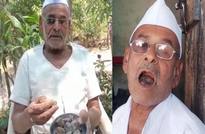 ​​ये हैं 80 साल के पत्थर वाले बाबा, एक दिन में चट कर जाते हैं 250 ग्राम पत्थर