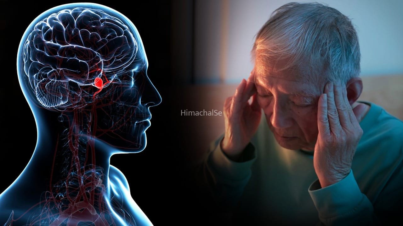 ब्रेन एन्यूरिज्म…दिमाग की नसों का गुबारे की तरह फूल जाना, ये क्यों होता है​