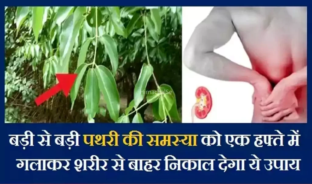 बड़ी से बड़ी पथरी की समस्या को एक हफ्ते में गलाकर शरीर से बाहर निकाल देगा ये उपाय​​​