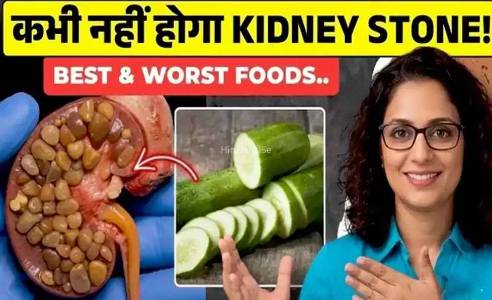 किडनी स्टोन को जड़ से तोड़ने वाले ये हैं 8 फूड्स और साथ में जानिए 5 ज़हर जैसे खाने, इन्हे आज ही छोड़ दें