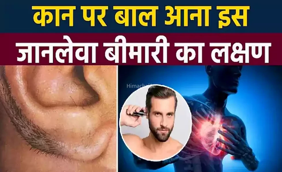 अगर कान पर दिख रहे हैं अचानक मोटे बाल, तो तुरंत हो जाएँ सावधान यह रहस्यमयी लक्षण दे सकता है खतरनाक बीमारी की चेतावनी