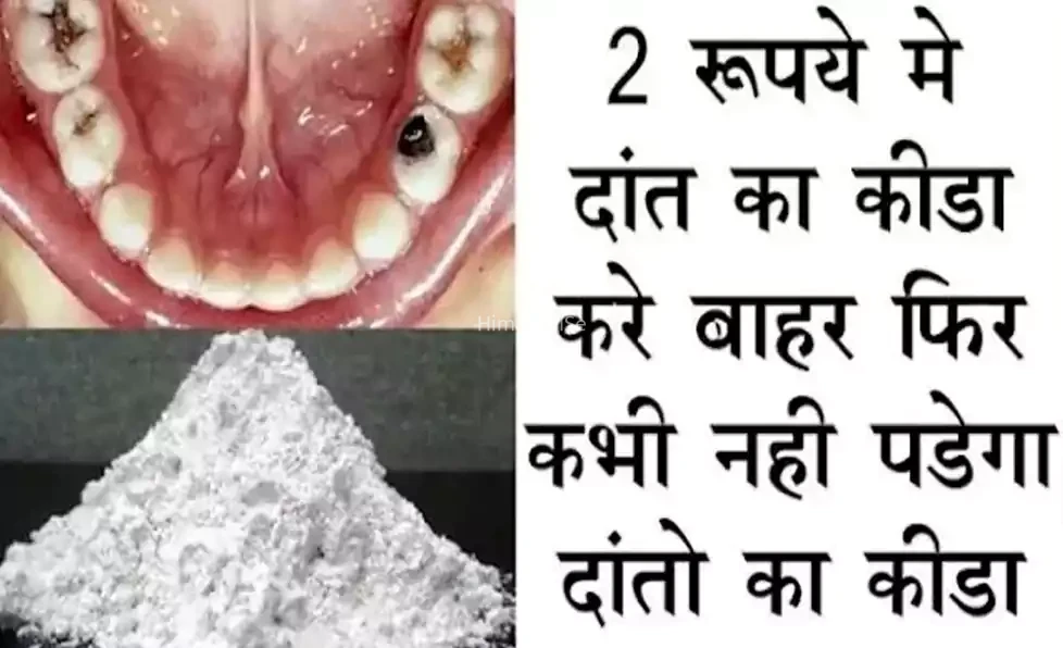 2 रुपये की यह एक चीज आपके दांत के कीड़ों को जड़ से कर देगी खत्म, नहीं यकीन तो एक बार क्लिक करके देख लो