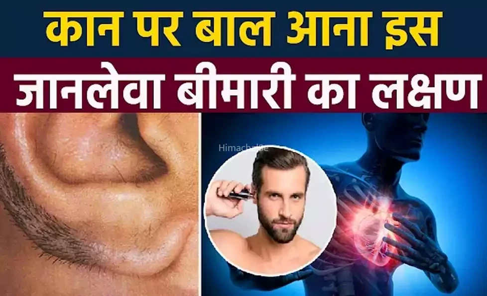 कान पर बाल दिखें तो हो जाएँ सावधान, इस जानलेवा बीमारी का है लक्षण. कान पर बाल होना है खतरनाक संकेत, जल्दी पढ़िए?