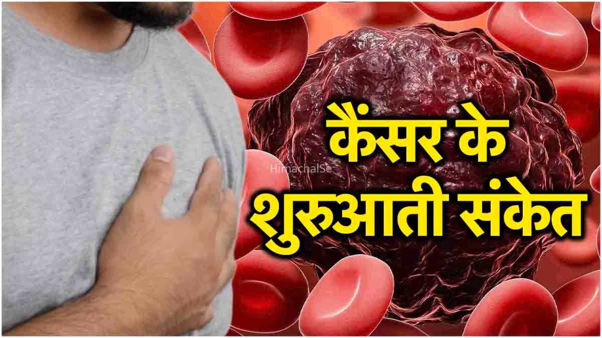 अगर कैंसर होने से पहले हो जाये सचेत तो इस भयावह रोग से हमेशा के लिए मिल सकता है छुटकारा​​​