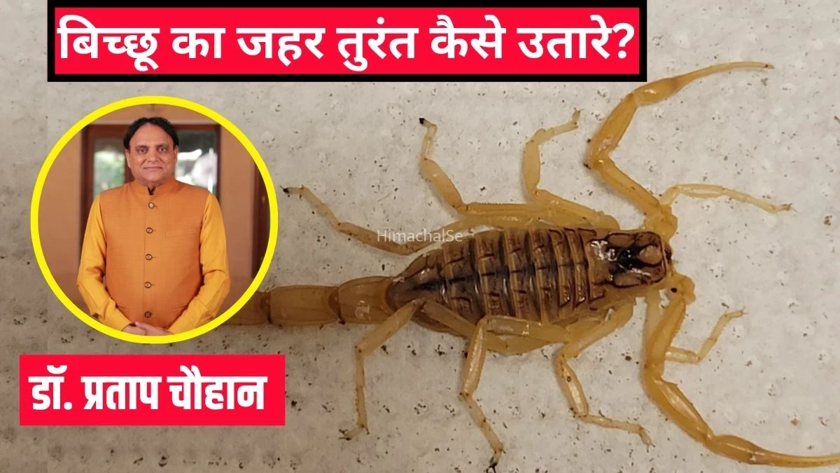 ​​बिच्छू का जहर तुरंत कैसे उतारे? आयुर्वेदिक डॉक्टर ने बताया बिच्छू के काटने पर क्या करना चाहिए