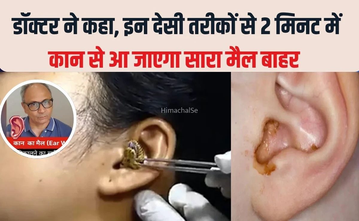 2 मिनट में कान का मैल आ जाएगा बाहर, सरसों के तेल में बस यह सफेद चीज मिलाकर डालें