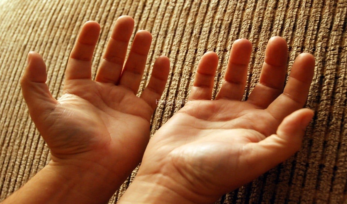 Marriage Line: हथेली की विवाह रेखा पर ये अशुभ निशान बिगाड़ सकते हैं आपका Relationship Status​