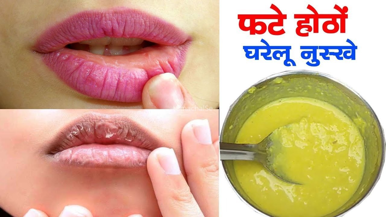 फटे होंठ एक दिन में मुलायम हो जाएंगे, दूध और गुलाब की पत्तियां इस तरह लगाएं