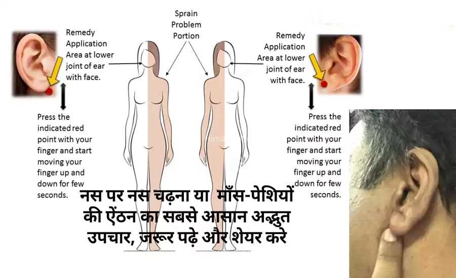 नस पर नस चढ़ना या माँस-पेशियों की ऐंठन का सबसे आसान अद्भुत उपचार, जरूर पढ़े और शेयर करे​​​