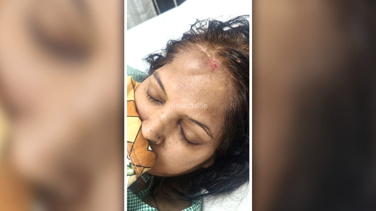 नोएडा में पिटबुल ने महिला पर किया हमला… 15 मिनट तक जबड़े में फंसा रहा हाथ​