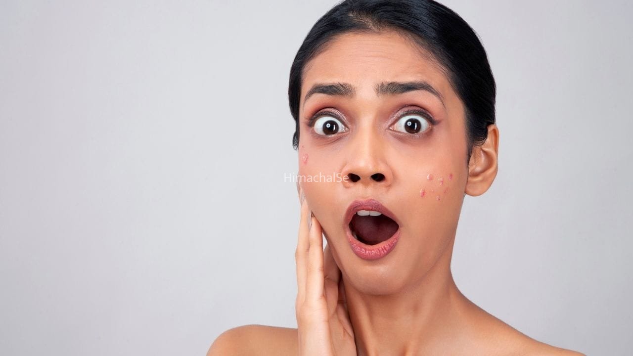 Skin Care Tips: फंगल एक्ने और रेगुलर एक्ने में क्या है अंतर? डर्मेटोलॉजिस्ट से जानें​