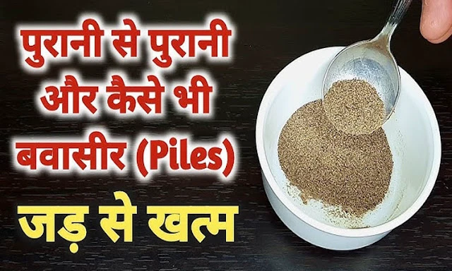 सालों पुरानी बवासीर का खात्मा सिर्फ 7 दिन में! जानिए वो राज जो आज तक छुपा था..