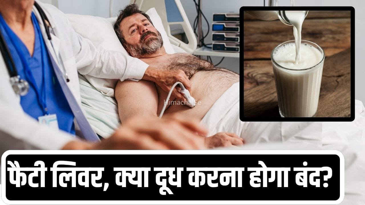 फैटी लिवर की है दिक्कत, पेशेंट को दूध पीना चाहिए या नहीं? डॉक्टर ने दिया जवाब​