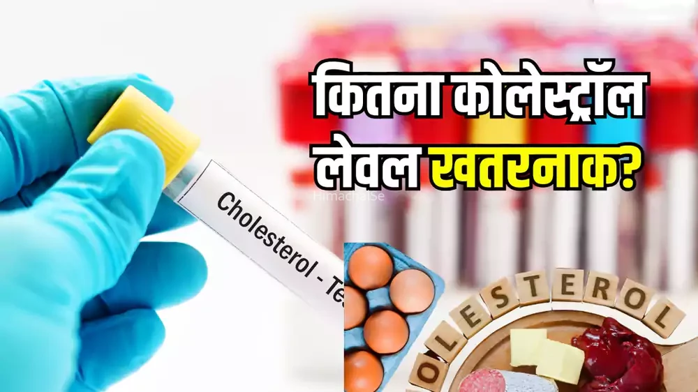 कितना बढ़ा कोलेस्ट्रॉल लेवल दिल के लिए बन सकता दुश्मन? कौन-सा Level है खतरनाक, कार्डियोलॉजिस्ट से बताई सच्चाई
