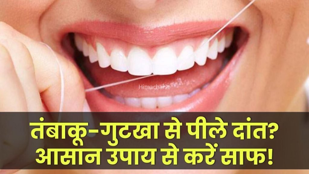 तंबाकू और गुटखा से पीले पड़े दांत? इन आसान उपायों से करें तुरंत साफ!​​​
