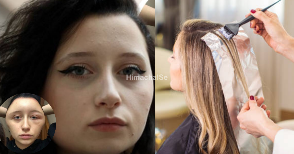 The-Girl-Bought-Hair-Dye-From-The-Supermarket-And-Was-Rushed-To-The-Hospital-The-Very-Next-Day-You-Will-Be-Shocked-To-Know-The-Reason